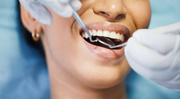 Best Emergency Dental Care for Broken or Chipped Teeth in Havre, MT
